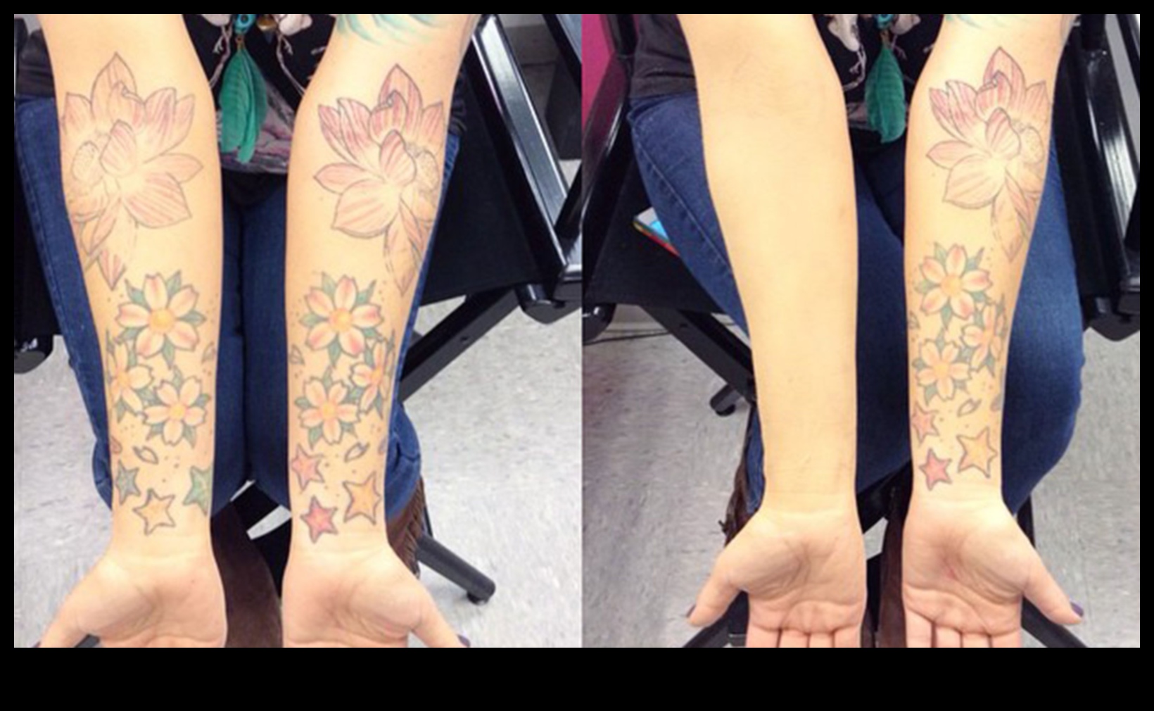 Camouflage Artistry: Mastering the Technique of Concealer Application