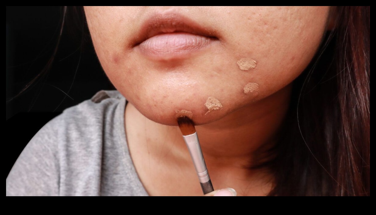 Concealer and Acne: How to Conceal Blemishes Without Aggravating Them