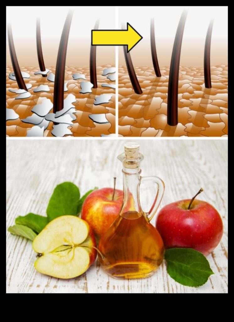 DIY ACV Adventures 50+ Creative Ways to Use Apple Cider Vinegar for Health and Wellness 1