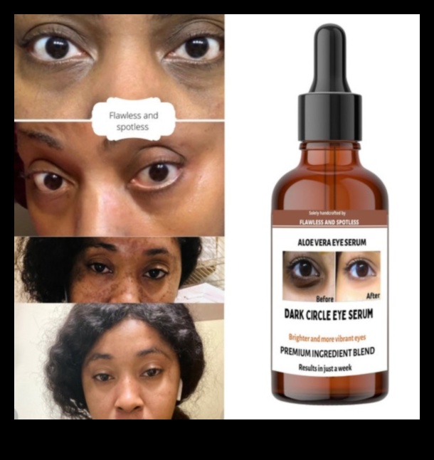 Skincare for Dark Circles: Strategies for Brightening the Eye Area