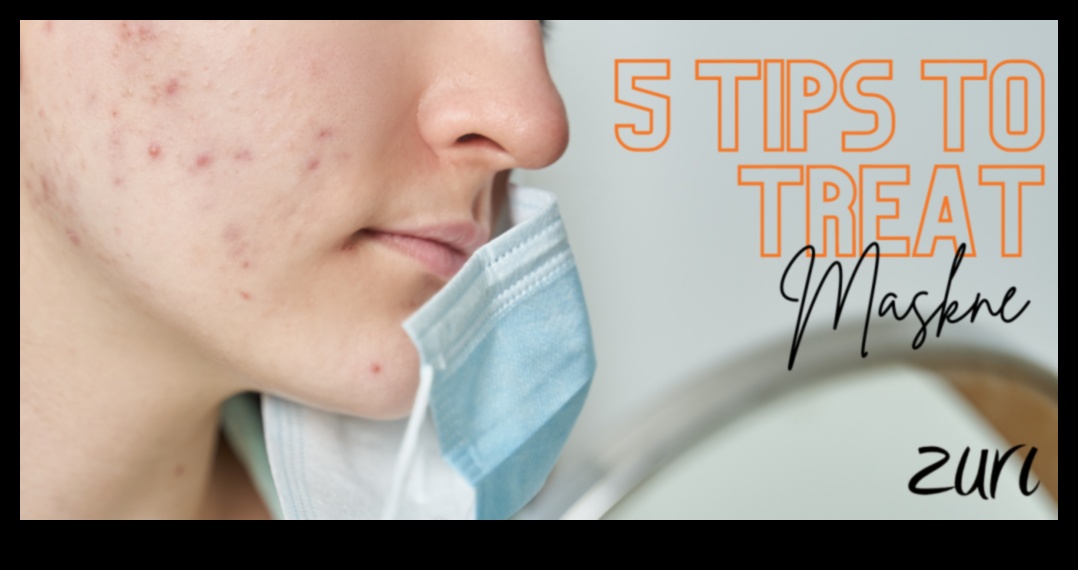 Skincare for Wearing Masks: Combatting Maskne and Irritation