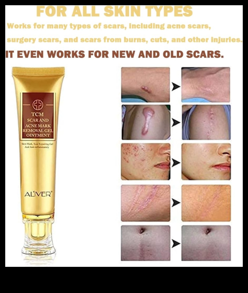 Skincare for Scarring: Promoting Healing and Reducing the Appearance of Marks