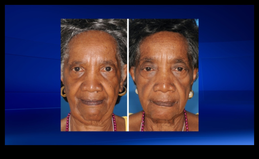 The Impact of Smoking on Your Skin: Minimizing Damage through Skincare