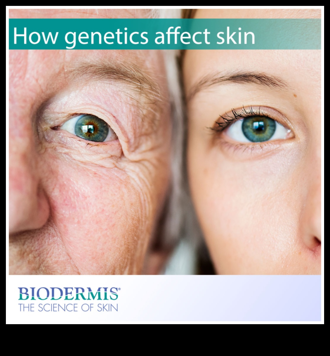 The Influence of Genetics on Skincare: Understanding Your Unique Needs